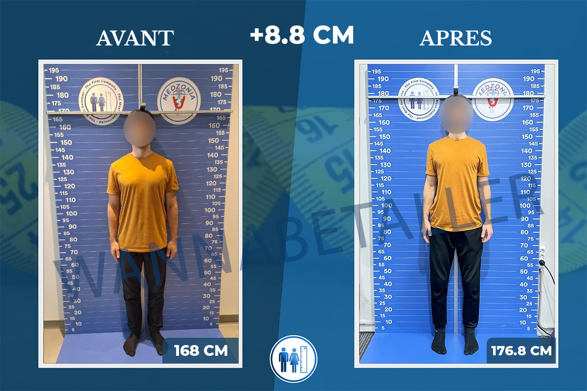 AVANT (2)
