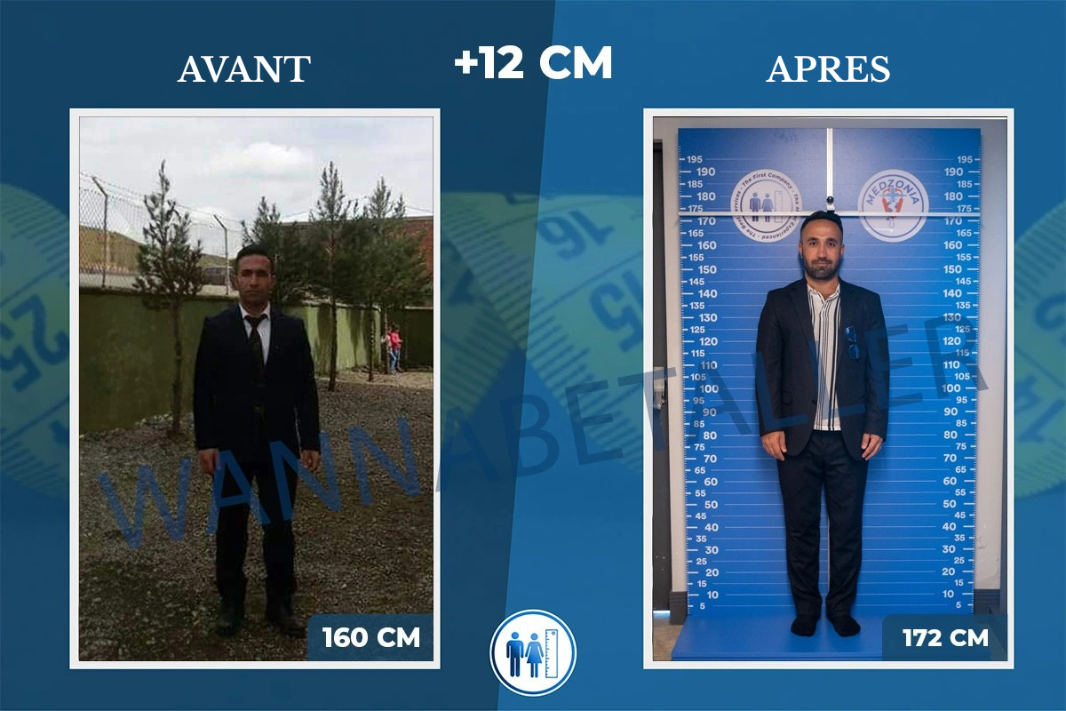 AVANT (4)