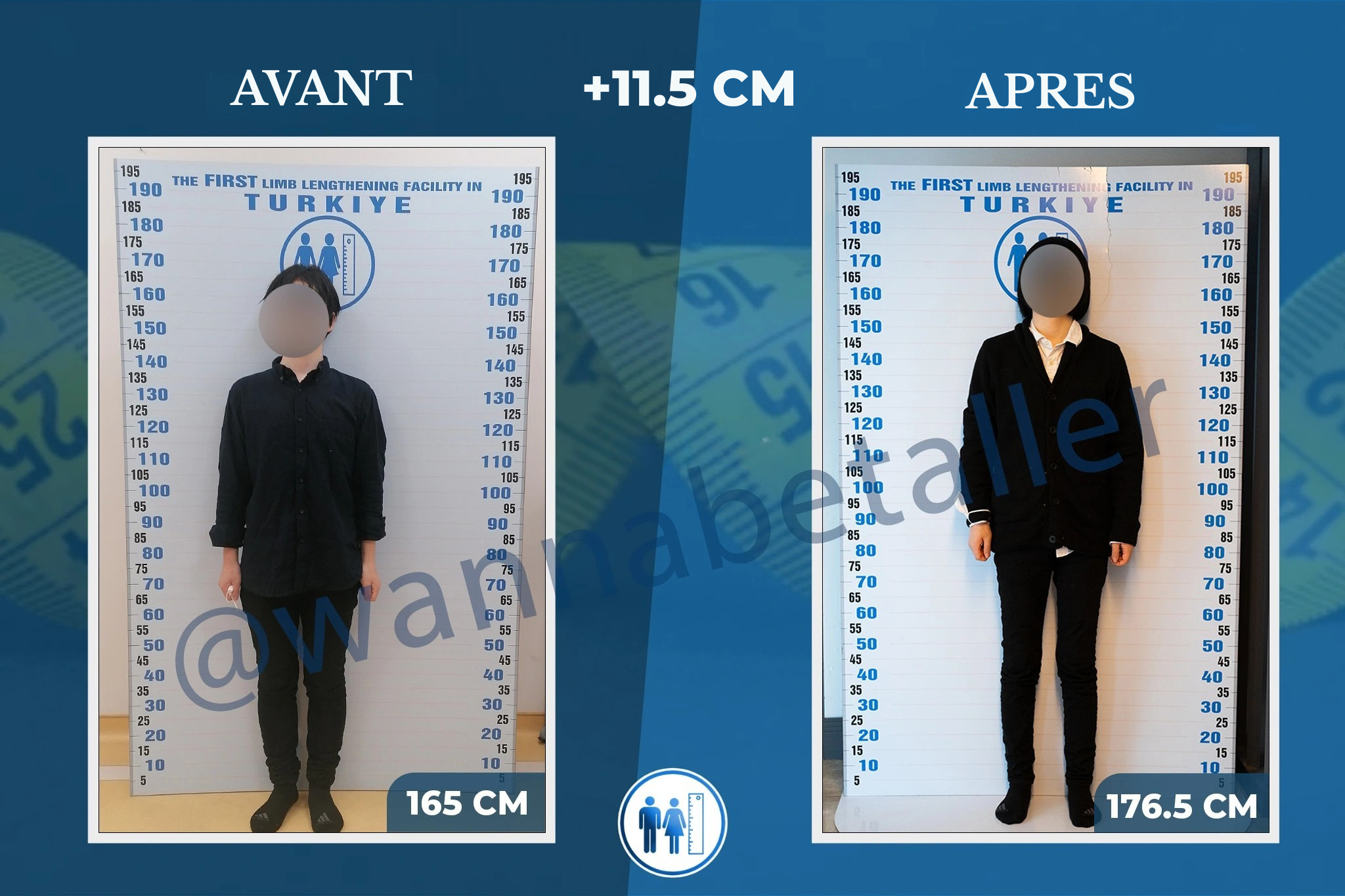 AVANT (5)
