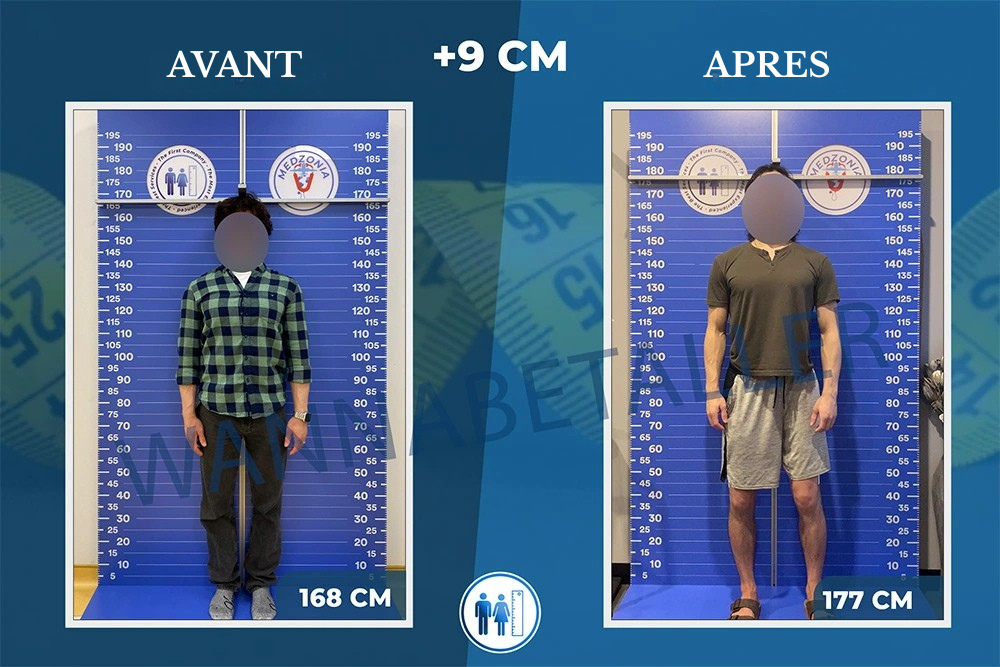 AVANT (6)