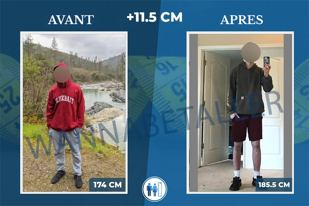 AVANT
