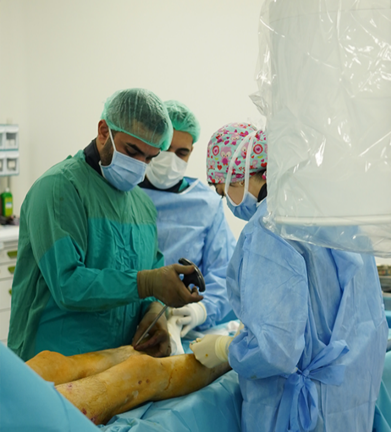 Témoignages allongement des jambes – Patients avant et après la chirurgie montrant des résultats visibles.