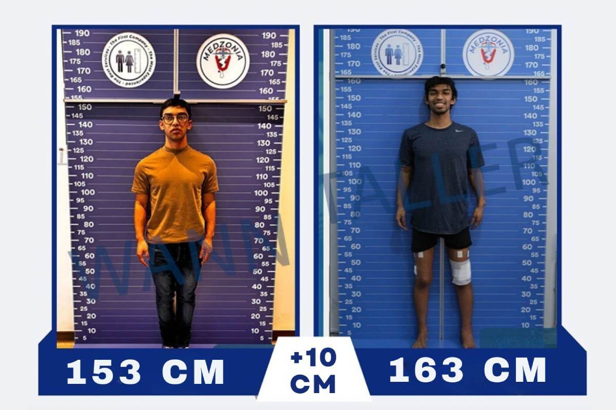Avant Après 30