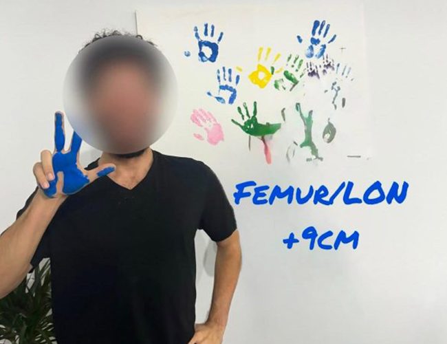 our-patients-pictures-12